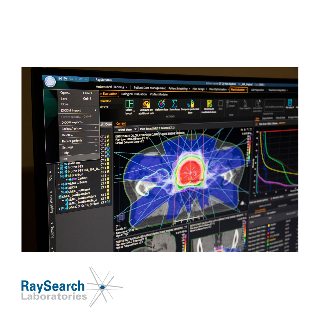 RayStation TPS